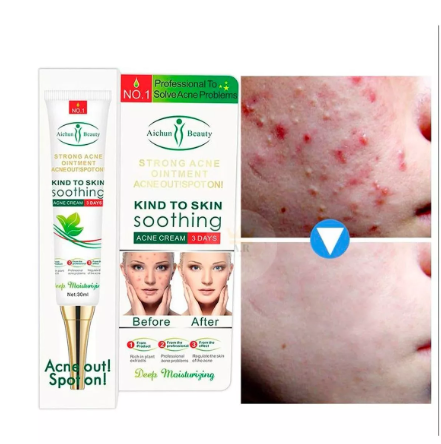 🌿 Aichun Beauty – Crema Facial Antiacné & Hidratante con Ácido Hialurónico 🌿