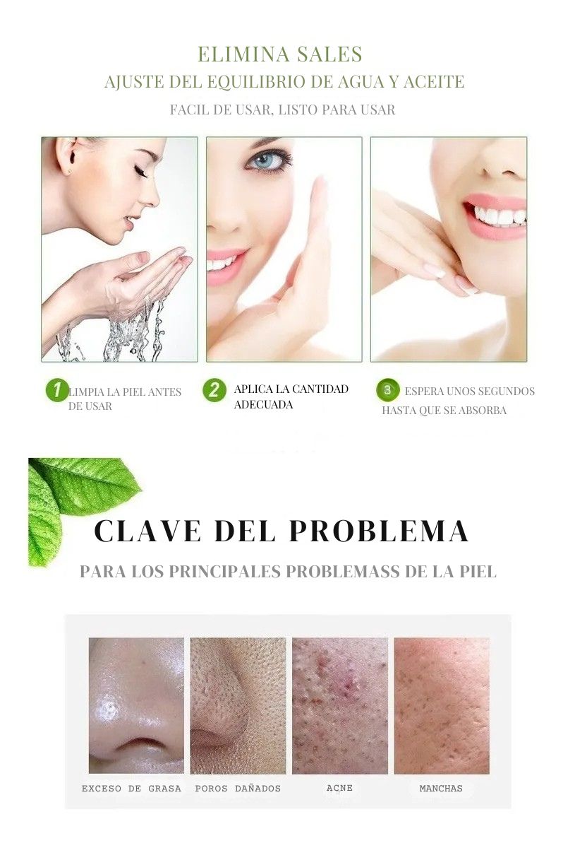 🌿 Aichun Beauty – Crema Facial Antiacné & Hidratante con Ácido Hialurónico 🌿